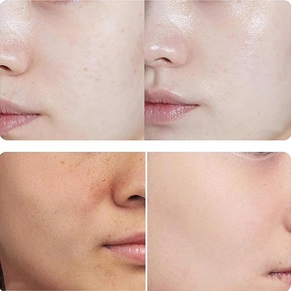 Serum facial con nicotinamida para cuidado de la piel